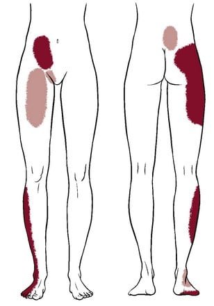 Sacroiliac Joint,
