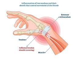 hand wrist