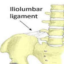 iliolumbar