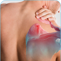 side frozen shoulder3