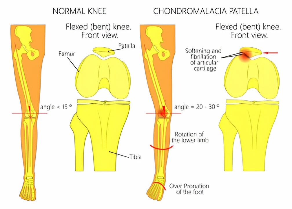 Downloader.la 6647086e4615b